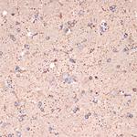 ABAT Antibody in Immunohistochemistry (Paraffin) (IHC (P))