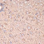 ABAT Antibody in Immunohistochemistry (Paraffin) (IHC (P))