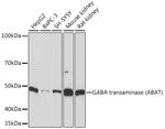 ABAT Antibody in Western Blot (WB)