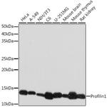 Profilin 1 Antibody in Western Blot (WB)