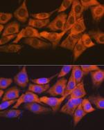 SOCS2 Antibody in Immunocytochemistry (ICC/IF)