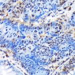 BCL11A Antibody in Immunohistochemistry (Paraffin) (IHC (P))