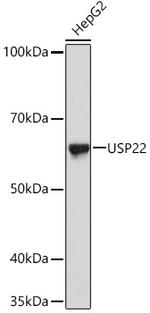 USP22 Antibody in Western Blot (WB)