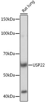 USP22 Antibody in Western Blot (WB)