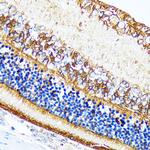 CRALBP Antibody in Immunohistochemistry (Paraffin) (IHC (P))