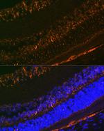 CRALBP Antibody in Immunohistochemistry (Paraffin) (IHC (P))