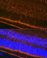 CRALBP Antibody in Immunohistochemistry (Paraffin) (IHC (P))