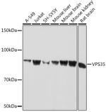 VPS35 Antibody in Western Blot (WB)