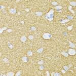 MUNC18 Antibody in Immunohistochemistry (Paraffin) (IHC (P))