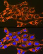 UQCRFS1 Antibody in Immunocytochemistry (ICC/IF)