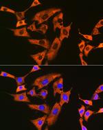 UQCRFS1 Antibody in Immunocytochemistry (ICC/IF)