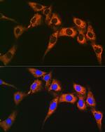 UQCRFS1 Antibody in Immunocytochemistry (ICC/IF)