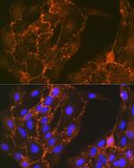 Cortactin Antibody in Immunocytochemistry (ICC/IF)