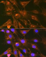 Cortactin Antibody in Immunocytochemistry (ICC/IF)