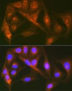 Cortactin Antibody in Immunocytochemistry (ICC/IF)