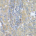 Cortactin Antibody in Immunohistochemistry (Paraffin) (IHC (P))