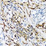 PSMB9 Antibody in Immunohistochemistry (Paraffin) (IHC (P))