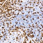 CD7 Antibody in Immunohistochemistry (Paraffin) (IHC (P))