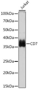 CD7 Antibody in Western Blot (WB)