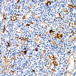 Fascin Antibody in Immunohistochemistry (Paraffin) (IHC (P))