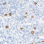 Fascin Antibody in Immunohistochemistry (Paraffin) (IHC (P))