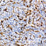 Fascin Antibody in Immunohistochemistry (Paraffin) (IHC (P))