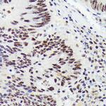 RNF40 Antibody in Immunohistochemistry (Paraffin) (IHC (P))