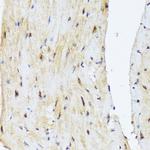 PSMD14 Antibody in Immunohistochemistry (Paraffin) (IHC (P))