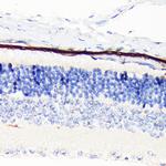 RPE65 Antibody in Immunohistochemistry (Paraffin) (IHC (P))