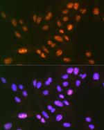 SF3B3 Antibody in Immunocytochemistry (ICC/IF)