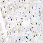 SF3B3 Antibody in Immunohistochemistry (Paraffin) (IHC (P))