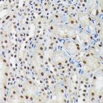 SF3B3 Antibody in Immunohistochemistry (Paraffin) (IHC (P))