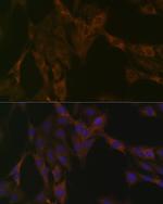 DDX6 Antibody in Immunocytochemistry (ICC/IF)