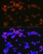 DC-SIGN Antibody in Immunocytochemistry (ICC/IF)