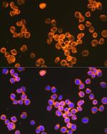 DC-SIGN Antibody in Immunocytochemistry (ICC/IF)