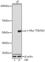 Phospho-c-Myc (Thr58, Ser62) Antibody in Western Blot (WB)