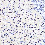 Phospho-IkB alpha (Ser36) Antibody in Immunohistochemistry (Paraffin) (IHC (P))