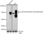 Phospho-PAK4/6/7 (Ser474, Ser602, Ser560) Antibody in Western Blot (WB)