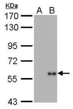 Influenza A H1N1 NP Antibody in Western Blot (WB)