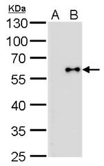 Influenza B NP Antibody in Western Blot (WB)