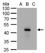 Dengue Virus Type 2 NS1 Antibody in Western Blot (WB)