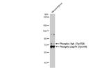 Phospho-Zap-70 (Tyr319, Tyr352) Antibody in Western Blot (WB)