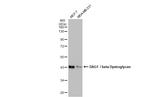 beta Dystroglycan Antibody in Western Blot (WB)