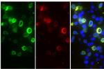 SARS-CoV/SARS-CoV-2 Nucleocapsid Antibody in Immunohistochemistry (Paraffin) (IHC (P))