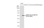 SARS-CoV/SARS-CoV-2 Nucleocapsid Antibody in Western Blot (WB)