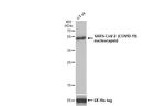 SARS-CoV/SARS-CoV-2 Nucleocapsid Antibody in Western Blot (WB)