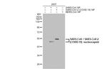 SARS-CoV/SARS-CoV-2 Nucleocapsid Antibody in Western Blot (WB)