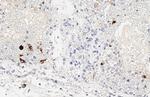 SARS/SARS-CoV-2 Spike Protein S2 Antibody in Immunohistochemistry (Paraffin) (IHC (P))