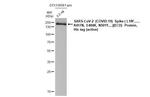 SARS/SARS-CoV-2 Spike Protein S2 Antibody in Western Blot (WB)