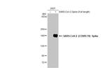 SARS/SARS-CoV-2 Spike Protein S2 Antibody in Western Blot (WB)